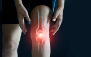 Alivio natural para articulaciones dolorosas